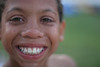 BurnFoundation > Champ Camp 2007-Pool Time photo